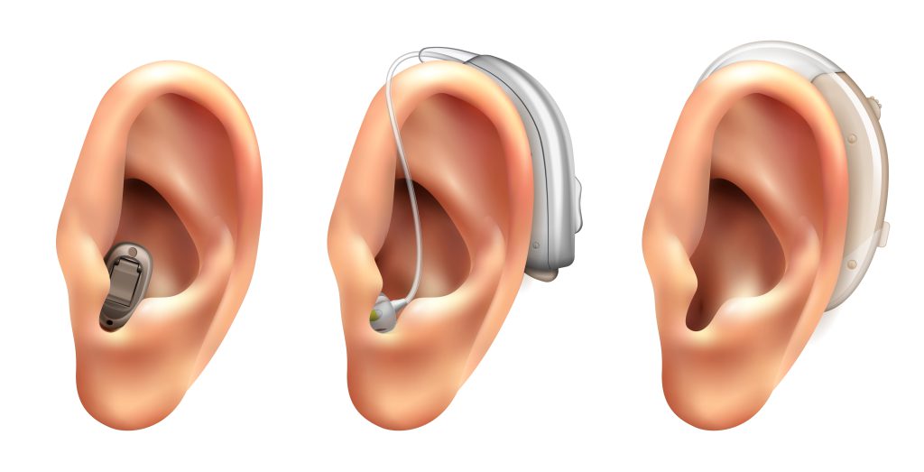 ilustracja przedstawiająca 3 rodzaje aparatów słuchowych i ich ułożenie na małżowinie usznej